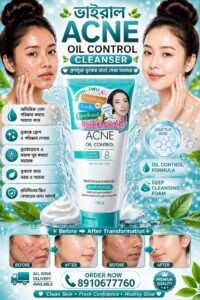✨ ACNE OIL CONTROL CLEANSING FOAM ✨